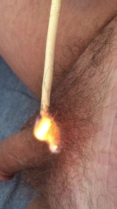 Burning Pubic Hair Xhamster