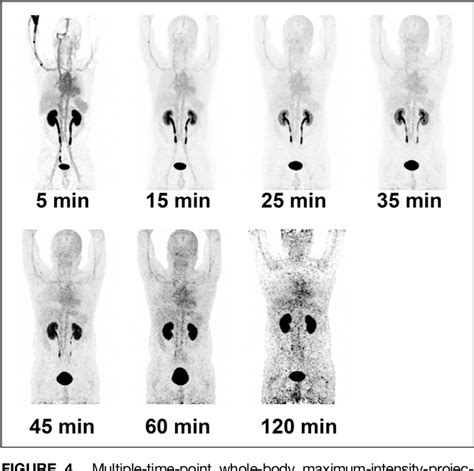 Figure 4 from Clinical Translation of a 68Ga Labeled Integrin αvβ6