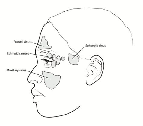 Maxillary Sinus Cancer