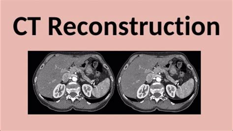 CT Reconstruction Analytical Reconstruction Iterative