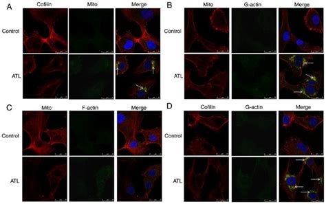 A The Levels Of Cofilin Red And Mitochondria Green In U87mg Cells