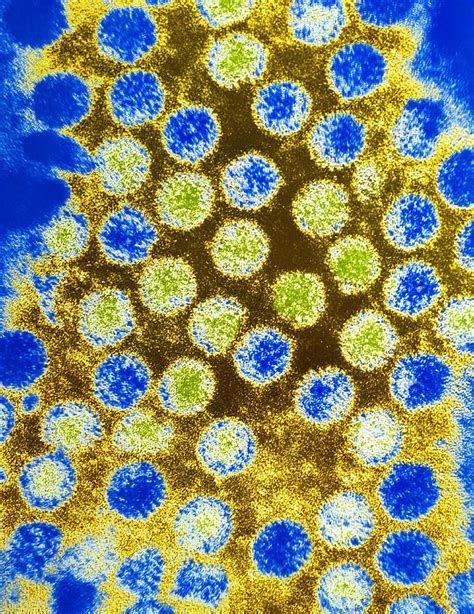 Coloured Tem Of Rotaviruses Photograph By Em Unit University Of