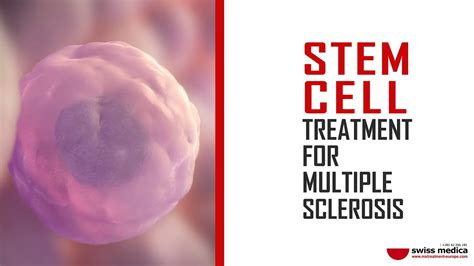 Stem Cell Treatment For Multiple Sclerosis Youtube