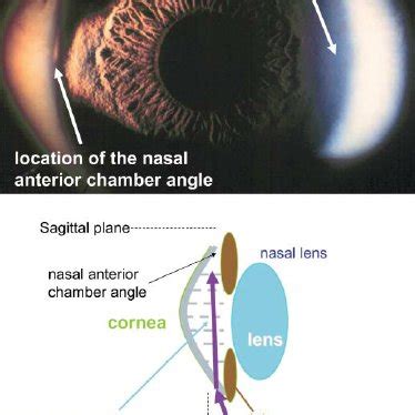 Peripheral Light Focusing Top Photograph Showing How A Beam Directed