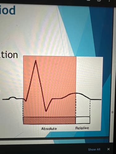 Block 4 EKG Flashcards Quizlet