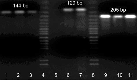 Detection Of Plasmodium Species Amplification In Nested Pcr Lanes