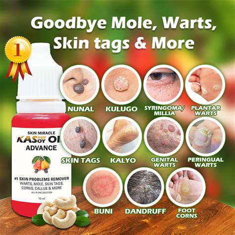 No Skin Problems Remover Mole Warts Skin Tag Effective