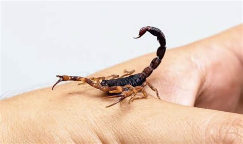 Five First Aid For Scorpion Bite Adorelifestyle