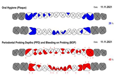 Periodontal Chart Online Perio Tools