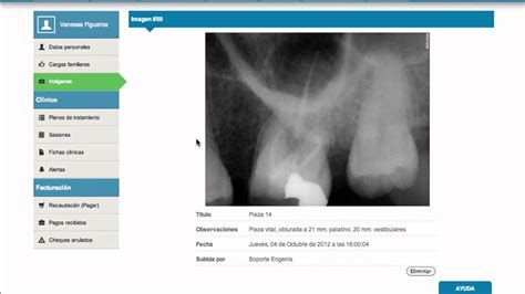 Dentalink Software Ficha Clinica Youtube