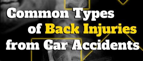 Types Of Back Injuries After A Car Accident Cassidy Baca P C