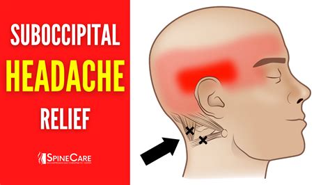 Self Occipital Release