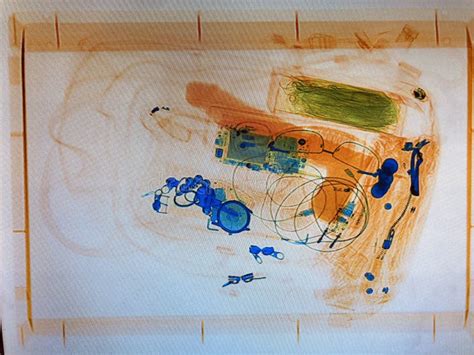 FotografÃa De Rayos X Del Dildo Foto de archivo Imagen de rayo mano