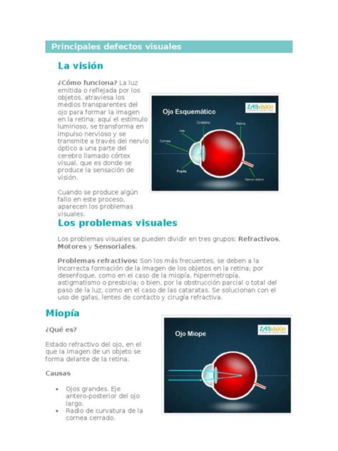 Principales Defectos Visuales