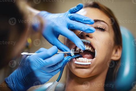 For The Most Beautiful Teeth 13879351 Stock Photo at Vecteezy