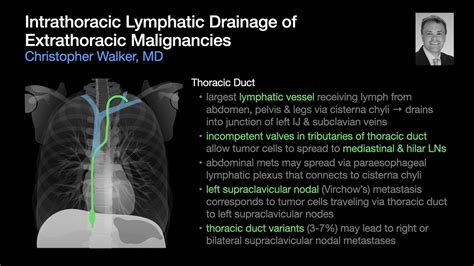 Society Of Thoracic Radiology On Twitter Dr Christopher Walker