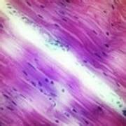 Cardiac Muscle Photograph By John Griffin University Of Queensland