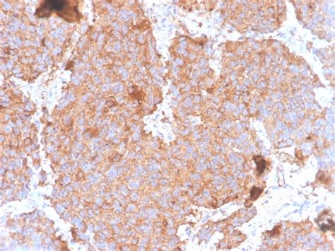 Recombinant Prolactin Pituitary Tumor Marker Antibody Clone PRL