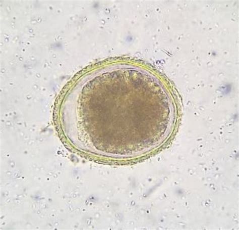 Parasites Vs Nematodes Cestodes And Trematodes Flashcards Quizlet