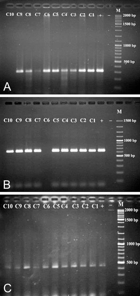 Agarose Gel Electrophoresis Of Plasmid Dna