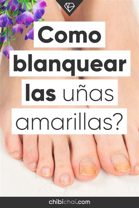 Como Blanquear Las U As Amarillas Como Blanquear Las U As Blanquear