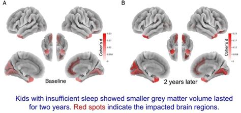 Children Who Lack Sleep May Experience Detrimental Impact on Brain ...