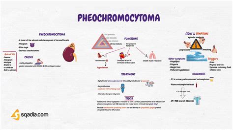 Pheochromocytoma