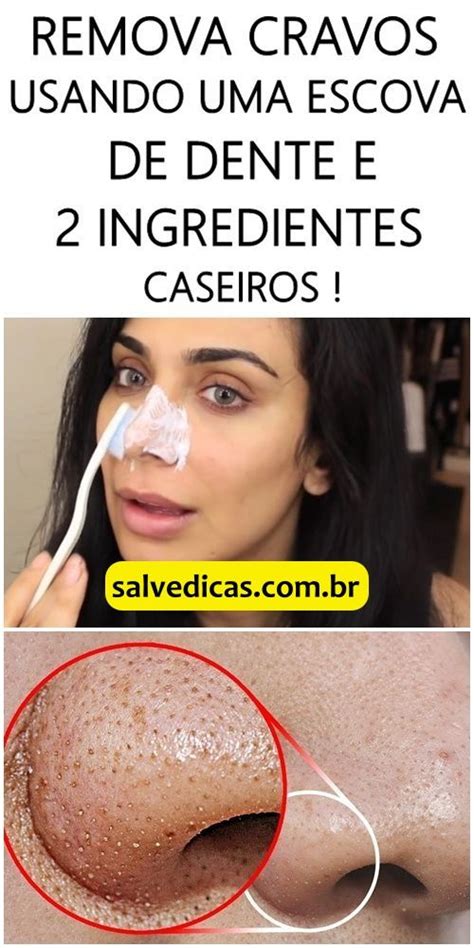 Como Remover Cravos Do Nariz Em Apenas 3 Minutos Fazendo Isso Como