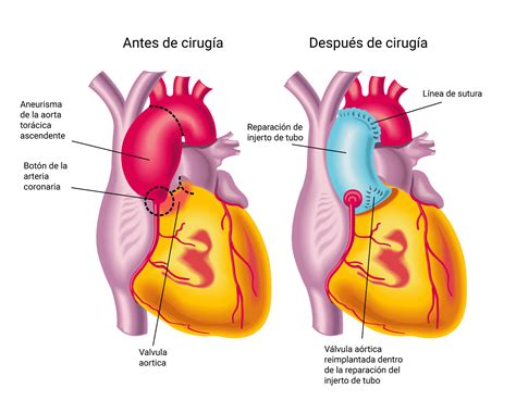 Cirug A Cardiovascular Centro M Dico Abc