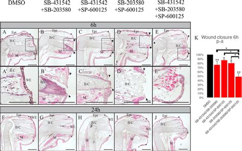 Effect Of Combinations Of Sb Sb And Sp On Wound