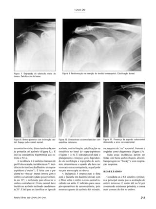 Raios X De Ombro Out Let Ou Y Escapular PDF