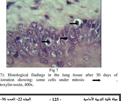 Figure 7 From Histological Changes In The Lung Tissues Of Male Albino