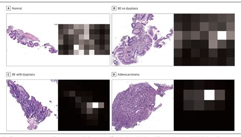 Figure From Attention Based Deep Neural Networks For Detection Of