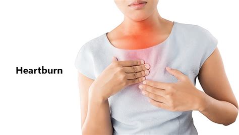 Heartburn Symptoms Causes Risk Factors Complication Home Remedies