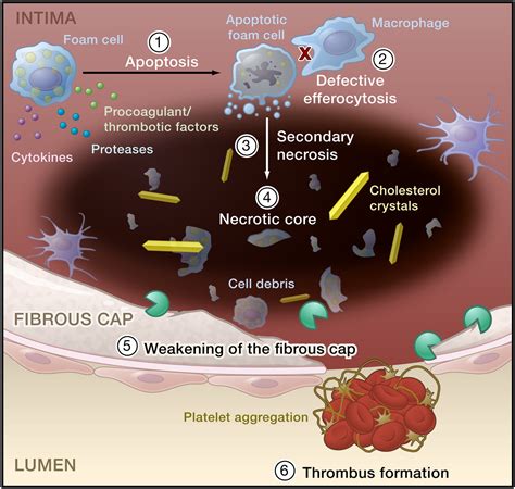 Macrophages In The Pathogenesis Of Atherosclerosis Cell