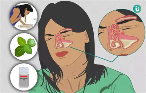 Ayurvedic Treatment Medicines Remedies Herbs For Sinusitis Types