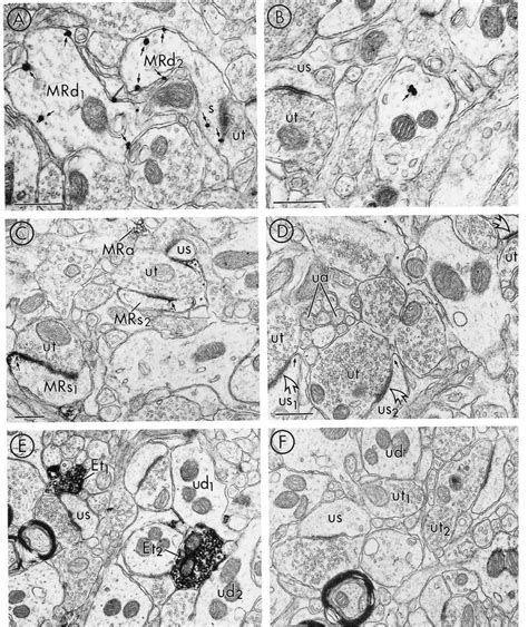 Electron Micrographs Showing Adsorption Controls For Mor And Le In