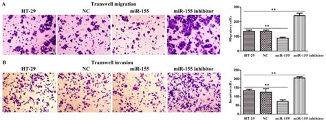 Microrna Acts As A Tumor Suppressor In Colorectal Cancer By