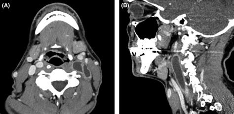 A Axial And B Sagittal Contrast‐enhanced Computed Tomography