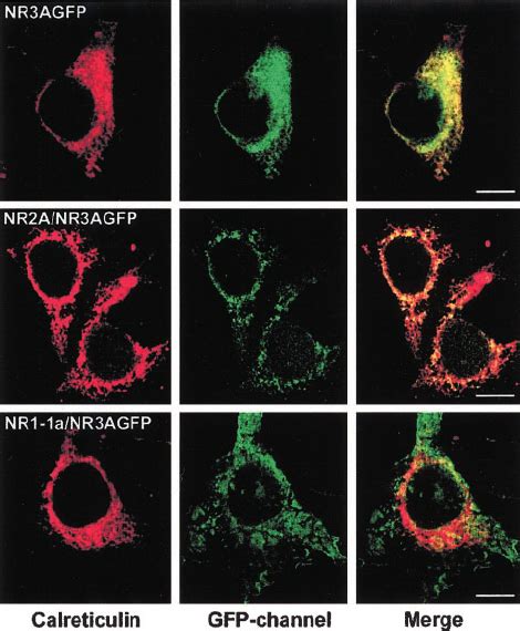 NR3A GFP Is Retained In The ER In The Absence Of The NR1 Subunit