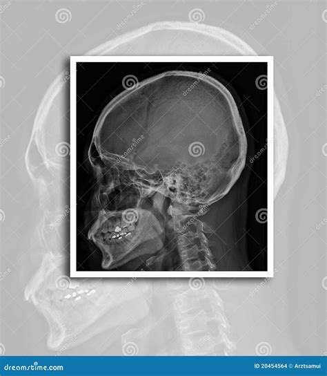 影片x 射线 库存照片 图片 包括有 工厂 诊断 女主持人 背包 照片 考试 健康 靠山 20454564