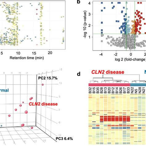 Unknown Metabolites 1 6 Differentiate Cln2 Disease Subjects From Normal