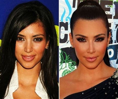 FOTOS Kim Kardashian antes y después de las cirugías Publimetro México