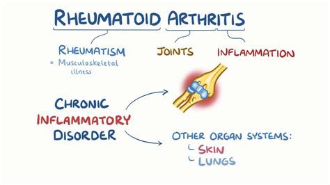 Rheumatoid Arthritis Video Anatomy Definition Osmosis