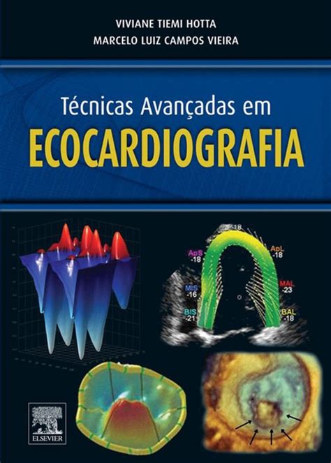 T Cnicas Avan Adas Em Ecocardiografia Ebook Viviane Tiemi Hotta