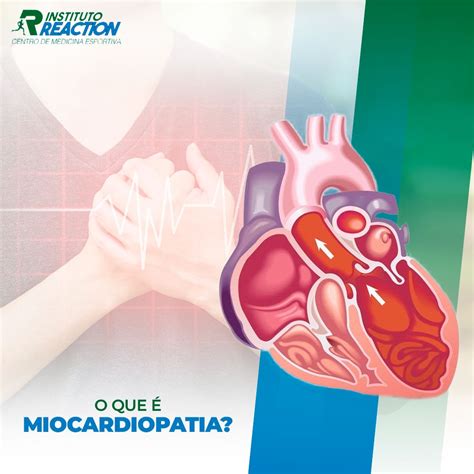 O Que É Miocardiopatia - O que é Miocardiopatia? - Instituto Reaction