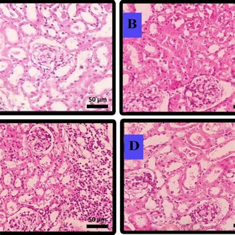 Histopathological Assessment Of Kidney Tissue In Different Mice Groups