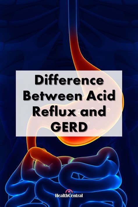 Acid Reflux And Gerd Whats The Difference Artofit