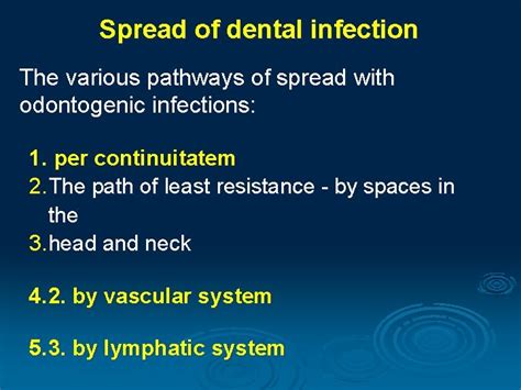 Odontogenic Infection Pathway Odontogenic Infections Are Caused By