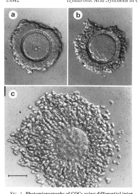 Figure From Synthesis And Accumulation Of Hyaluronic Acid And